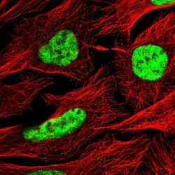 C1orf226 Antibody, Novus Biologicals 25 &mu;L, Unlabeled:Antibodies, Polyclonal